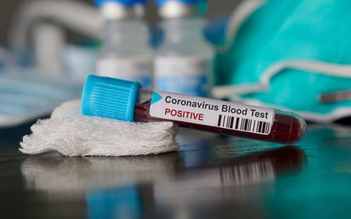 Volta, Western Regions record first cases of COVID-19
