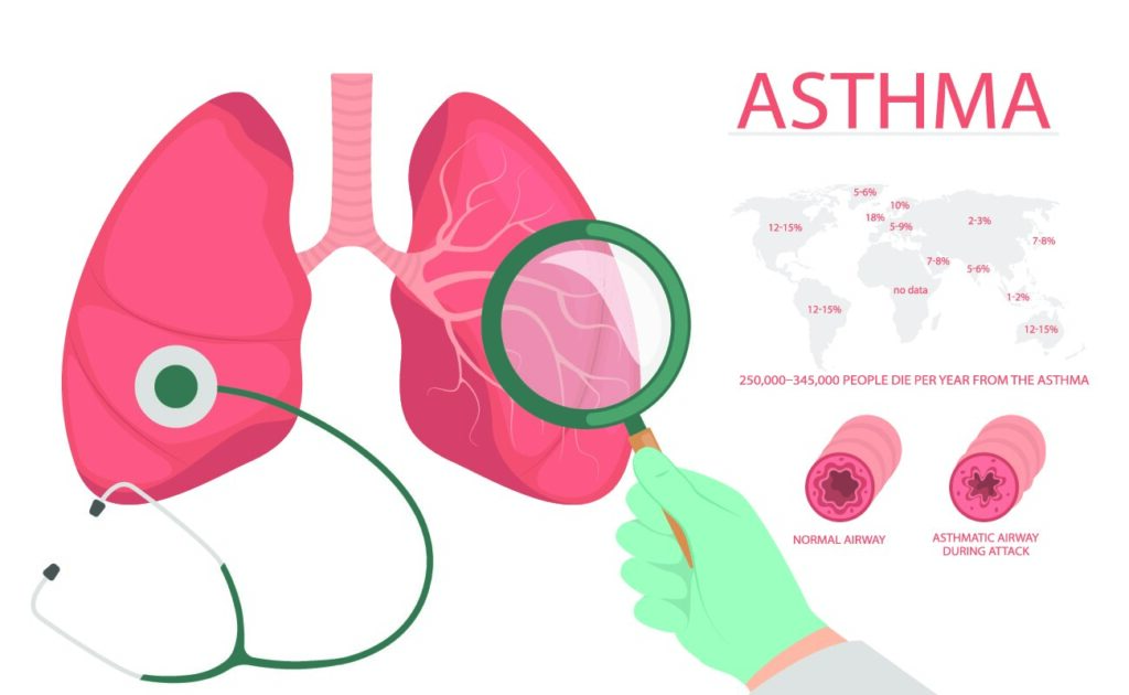 Asthma: Overview, Causes, Signs And Symptoms And Treatment/Management
